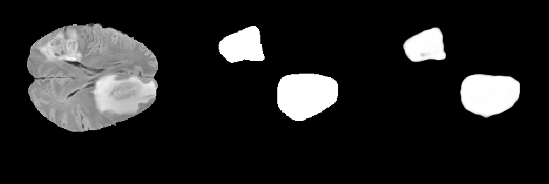 Segmentation animation (T1 example)