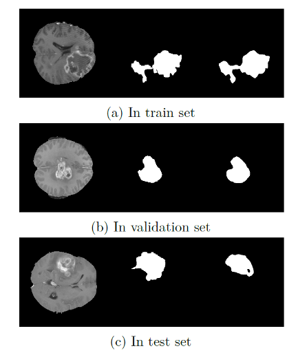 FLAIR segmentation examples — train / validation / test