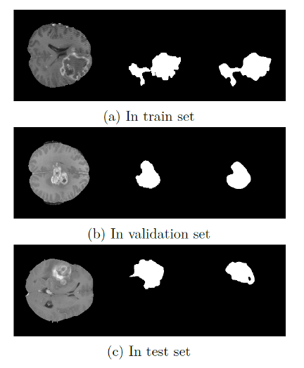 T1 segmentation examples — train / validation / test