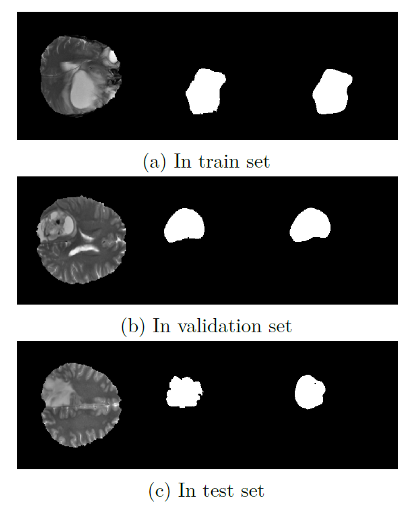 T2 segmentation examples — train / validation / test